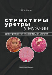Стриктуры уретры у мужчин. Реконструктивно-восстановительная хирургия