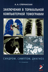 Заключения в торакальной компьютерной томографии. Симптом, синдром, диагноз