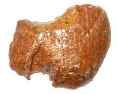 Кариес