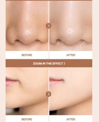 Набор Карбокситерапия Лицо+Шея Medisco TokTok Pack (1 упаковка 5 штук по 25 гр.) до 14.10.2024