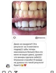 NEW! Профессиональные полоски для бережного отбеливания зубов