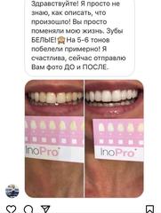 NEW! Профессиональные полоски для бережного отбеливания зубов