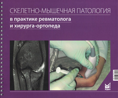 Скелетно-мышечная патология в практике ревматолога и хирурга-ортопеда