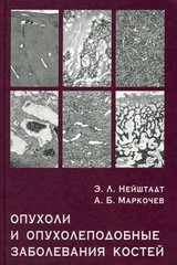 Опухоли и опухолеподобные заболевания костей