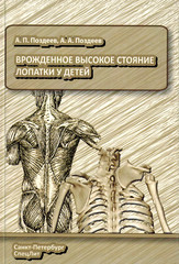 Врождённое высокое стояние лопатки у детей