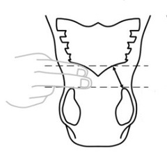 Наклейка на нос лошади, улучшающая дыхание