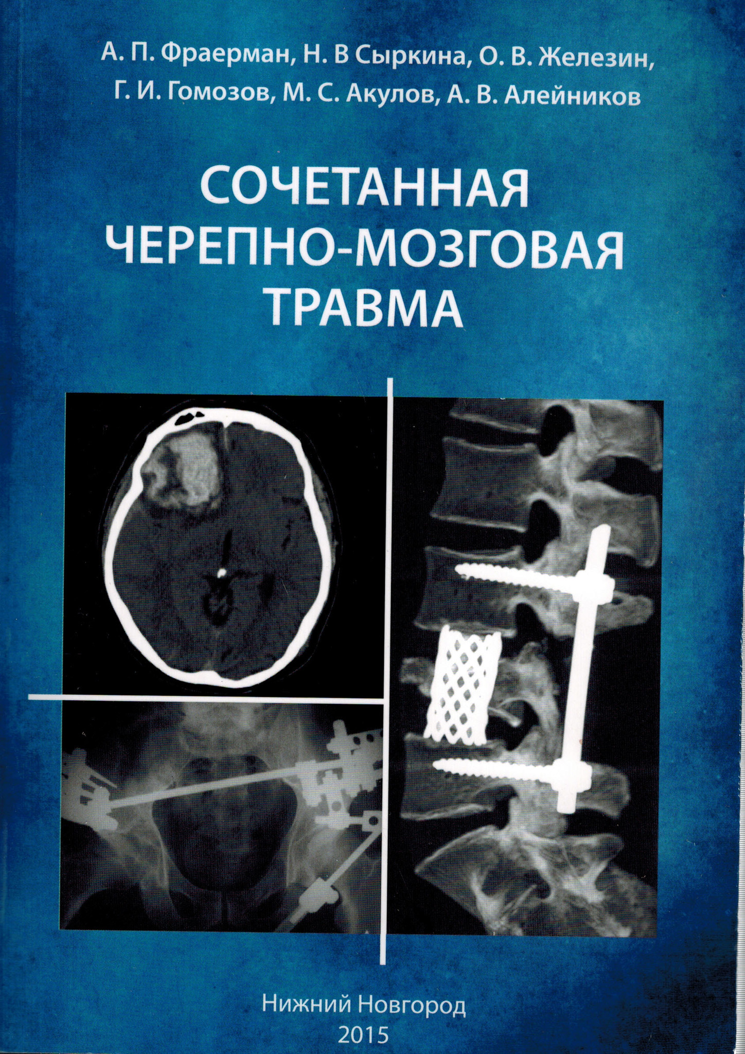 Сочетанная травма. Комбинированная черепно мозговая травма это. Сочетанная черепно-мозговая травма. Комбинированные и сочетанные черепно мозговые травмы. Церебральное повреждение.