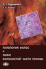 Патология волос и кожи волосистой части головы / Корнишева В. Г., Ежков Г. А. (электронная версия в формате PDF)
