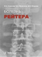 Болезнь Рейтера