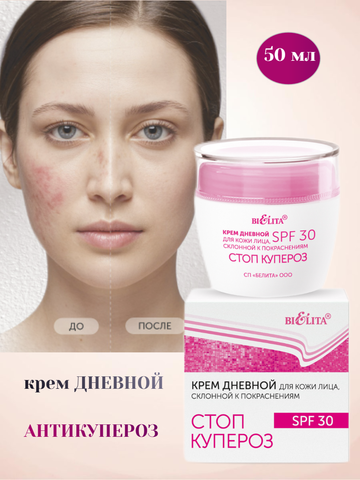 Стоп купероз Крем дневной для кожи лица, склонной к покраснениям SPF30 50мл