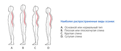Корректор осанки для взрослых 