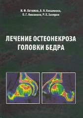 Лечение остеонекроза головки бедра
