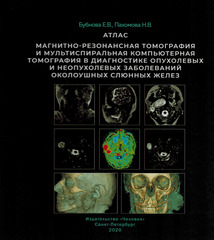 Магнитно-резонансная томография и мультиспиральная компьютерная томография в диагностике опухолевых и неопухолевых заболеваний околоушных слюнных желез. Атлас
