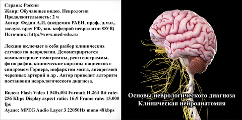 Купить диск Основы неврологического диагноза. Клиническая нейроанатомия