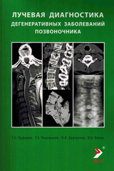 Лучевая диагностика дегенеративных заболеваний позвоночника