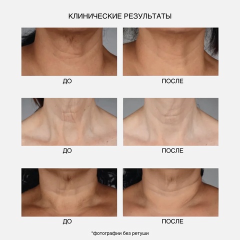 IS CLINICAL NeckPerfect Complex Интенсивный anti-age крем для шеи, 50 мл