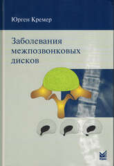Заболевания межпозвонковых дисков