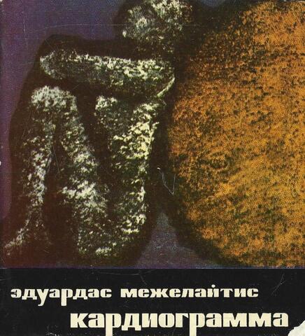 Кардиограмма