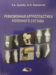 Ревизионная артропластика коленного сустава