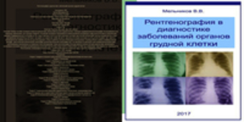 Мельников В.В. - Рентгенография в диагностике заболеваний органов грудной клетки