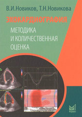 Эхокардиография. Методика и количественная оценка