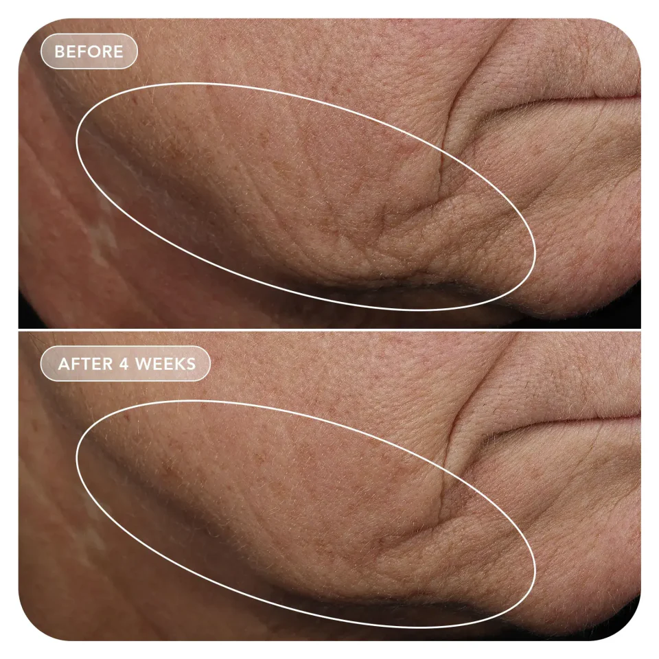 IMAGE VOL.U.LIFT™ GLP-1 4D Skin Rebound Complex Уплотняющий крем при приеме оземпика