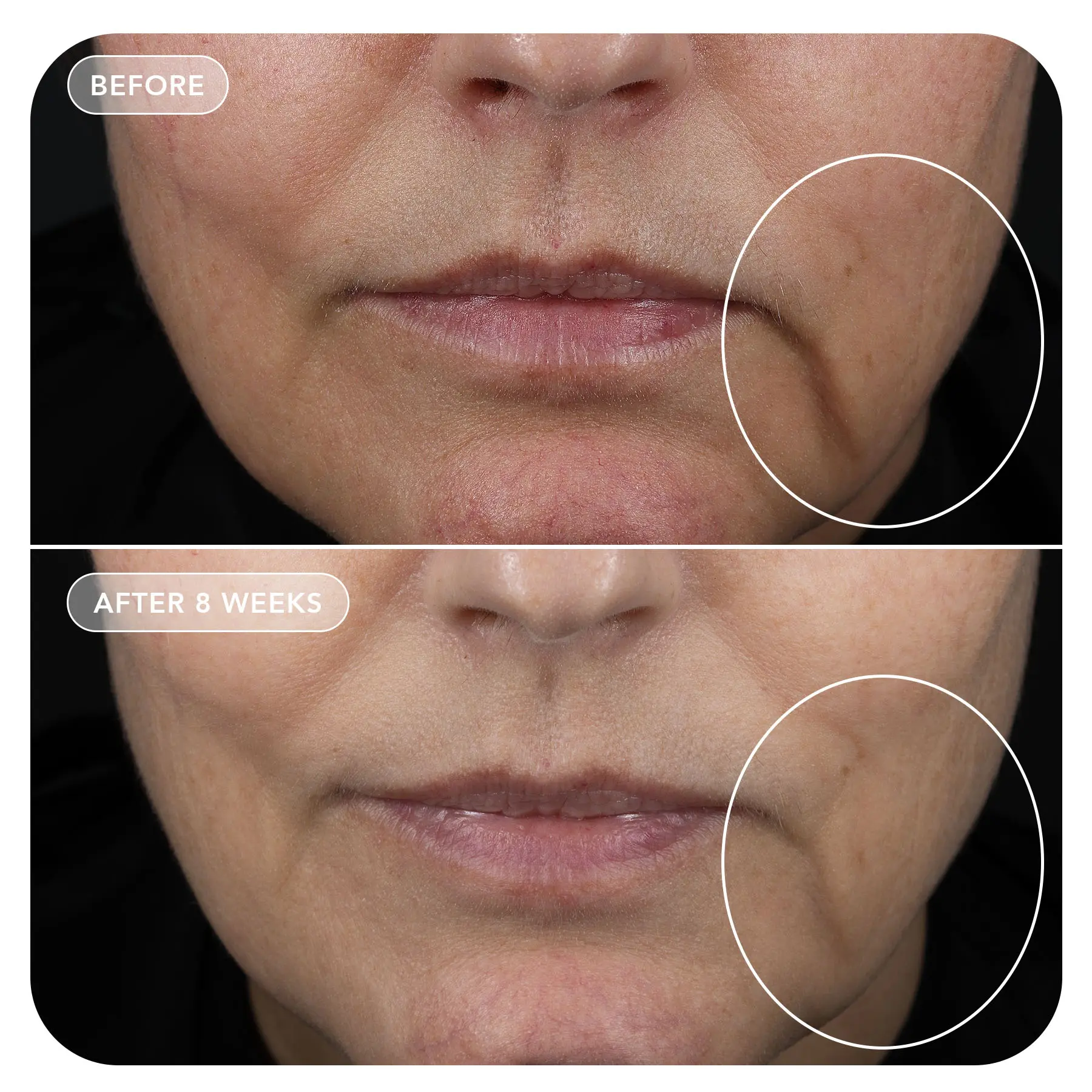 IMAGE VOL.U.LIFT™ GLP-1 4D Skin Rebound Complex Уплотняющий крем при приеме оземпика