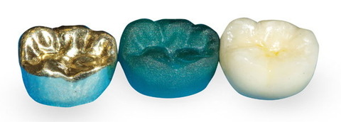 3D-принтер 3D Systems ProJet MJP 3600 Dental