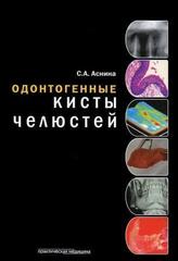 Одонтогенные кисты челюстей