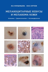 Меланоцитарные невусы и меланома кожи (Мордовцева В.В., Сергеев Ю.Ю.)