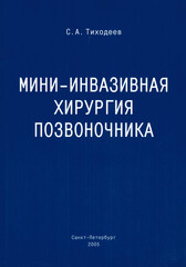 Мини-инвазивная хирургия позвоночника