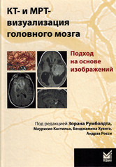 КТ и МРТ визуализация головного мозга. Подход на основе изображений