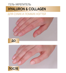 LuxVisage Средство по уходу за ногтями Гель-укрепитель HYALURON&COLLAGEN 9мл