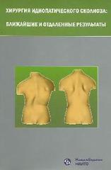 Хирургия идиопатического сколиоза: ближайшие и отдаленные результаты