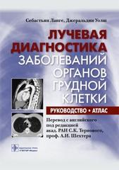 Лучевая диагностика заболеваний органов грудной клетки: руководство: атлас