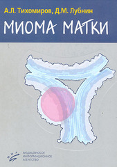Миома матки