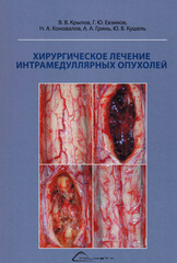 Хирургическое лечение интрамедуллярных опухолей