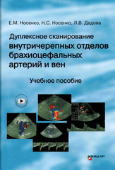 Дуплексное сканирование внутричерепных отделов брахиоцефальных артерий и вен
