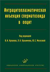 Интрацитоплазматическая инъекция сперматозоида в ООЦИТ