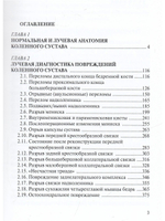 Лучевая диагностика повреждений коленного сустава