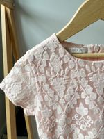 Кружевное платье Liu-Jo, 104