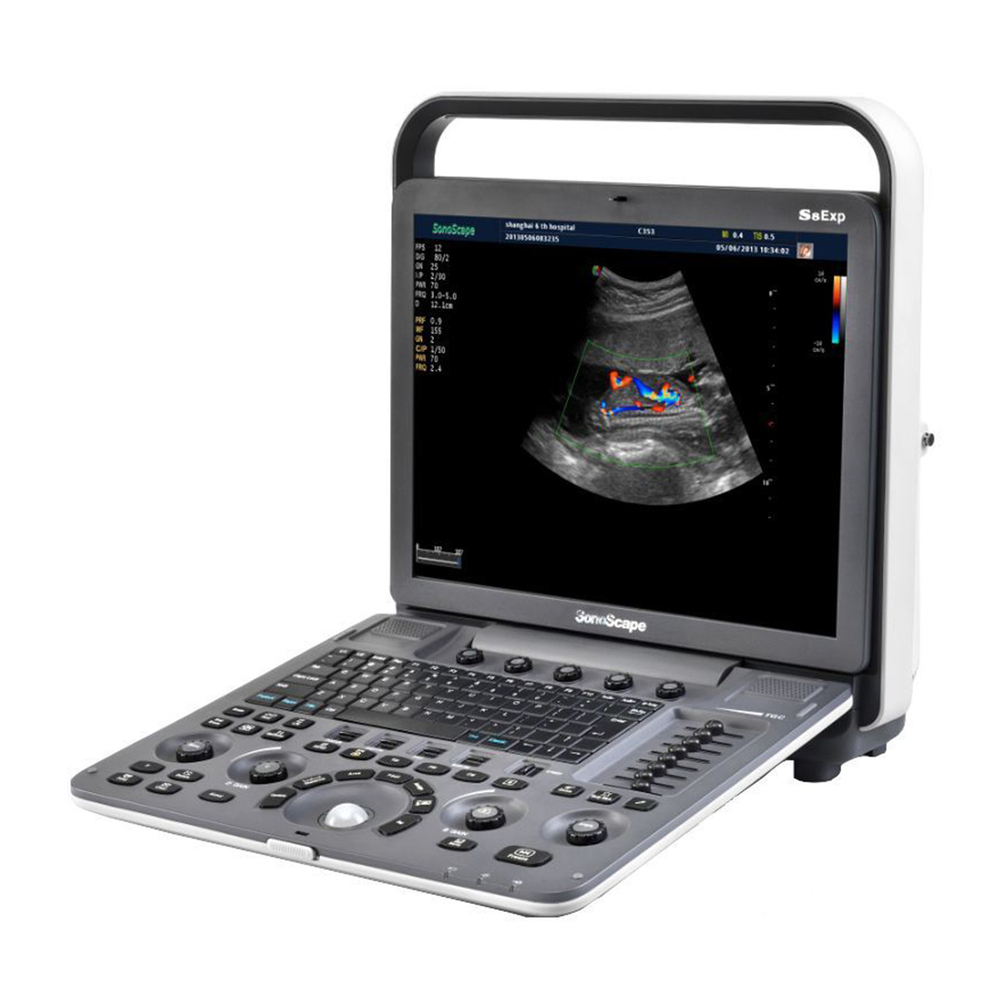Ультразвуковой аппарат SonoScape S8Exp