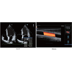 Аппарат УЗИ (сканер) Mindray DC-60 Exp