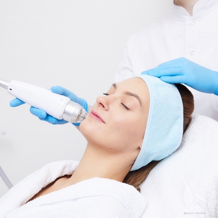 Микроигольчатый RF-лифтинг, 1ч