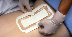 Tegaderm+pad - повязка с абсорбирующей прокладкой