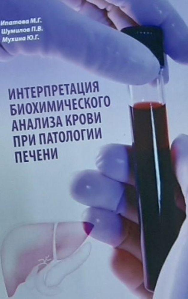 Интерпретация биохимического анализа крови при патологии печени