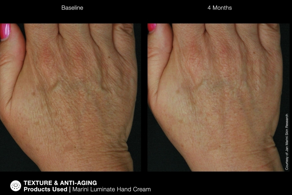 JAN MARINI RENU CORRECTIVE HAND COMPLEX Антивозрастной корректирующий крем для рук