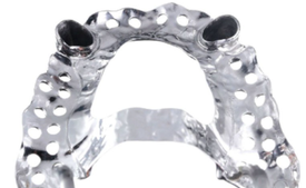 Протез с креплением на телескопах