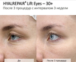 Hyalrepair Lift Eyes | ГК 12 мг/мл + Вит.С и Аминокислоты