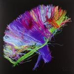 Muse / The 2nd Law (Limited Edition)(2LP+CD+DVD)